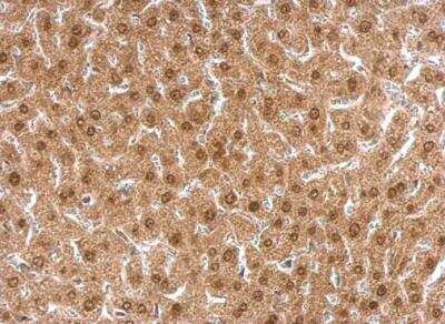 Immunohistochemistry-Paraffin: APLP-2 Antibody [NBP1-32814]