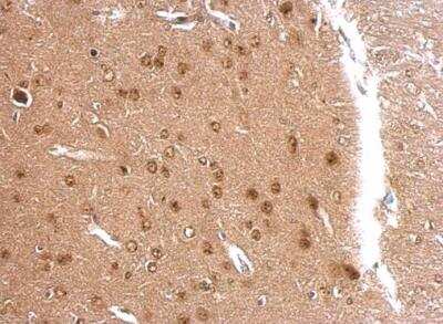 Immunohistochemistry-Paraffin: APLP-2 Antibody [NBP1-32814]