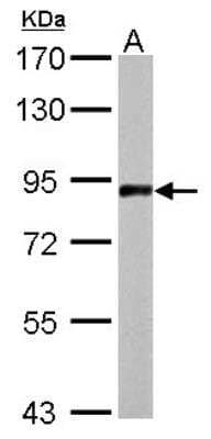 Western Blot: APLP-2 Antibody [NBP1-32814]