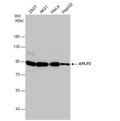 Western Blot: APLP-2 Antibody [NBP1-32814]