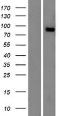 Western Blot: APLP-2 Overexpression Lysate [NBP2-09626]