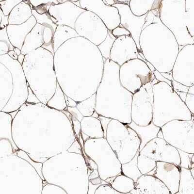 Immunohistochemistry-Paraffin: APM2 Antibody [NBP2-30736]