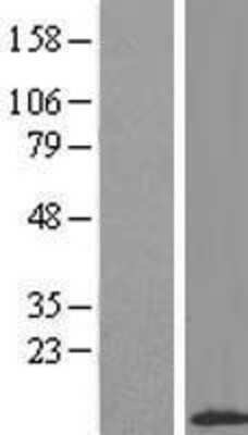 Western Blot: APM2 Overexpression Lysate [NBL1-08071]