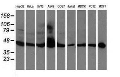 Western Blot: APMAP Antibody (OTI4F6) [NBP2-01716]