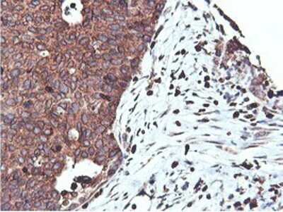 Immunohistochemistry: APMAP Antibody (OTI4F6) - Azide and BSA Free [NBP2-72080]