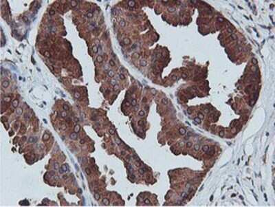 Immunohistochemistry: APMAP Antibody (OTI4F6) - Azide and BSA Free [NBP2-72080]