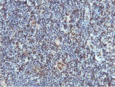 Immunohistochemistry: APMAP Antibody (OTI4F6) - Azide and BSA Free [NBP2-72080]