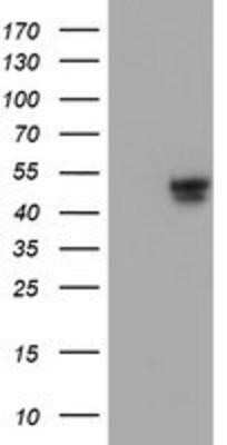 Western Blot: APMAP Antibody (OTI4F6)Azide and BSA Free [NBP2-72080]