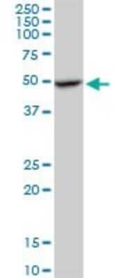 Western Blot: APMAP Antibody [H00057136-B01P]