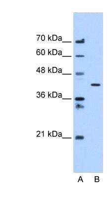 Western Blot: APMAP Antibody [NBP1-59984]