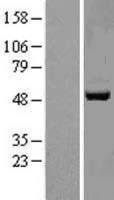 Western Blot: APMAP Overexpression Lysate [NBL1-08371]