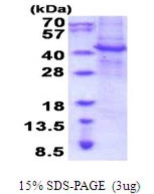 SDS-PAGE: Recombinant Human APMAP His Protein [NBP2-51969]