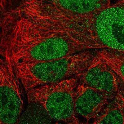 Immunocytochemistry/ Immunofluorescence: APOA1BP Antibody [NBP2-30943]