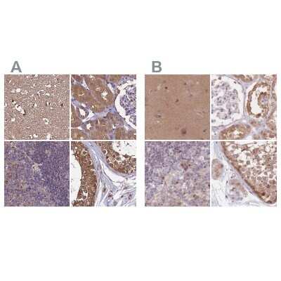 Immunohistochemistry-Paraffin: APOA1BP Antibody [NBP2-30943]