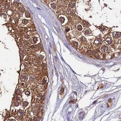 Immunohistochemistry-Paraffin: APOA1BP Antibody [NBP2-30943]