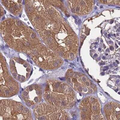 Immunohistochemistry-Paraffin: APOA1BP Antibody [NBP2-30943]