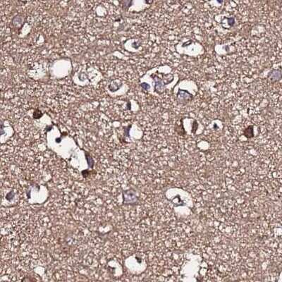 Immunohistochemistry-Paraffin: APOA1BP Antibody [NBP2-30943]