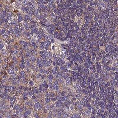 Immunohistochemistry-Paraffin: APOA1BP Antibody [NBP2-30943]