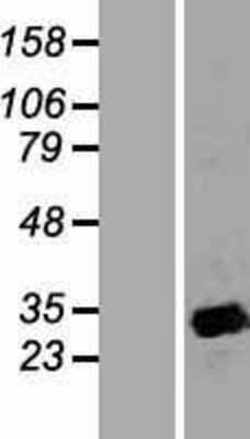 Western Blot: APOA1BP Overexpression Lysate [NBP2-05519]