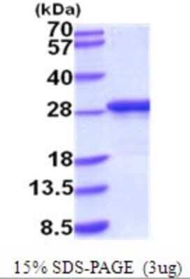 SDS-PAGE: Recombinant Mouse Apolipoprotein A-I/ApoA1 His Protein [NBP2-52061]