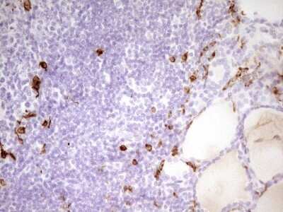 Immunohistochemistry: APOB48R Antibody (OTI1B1) [NBP2-46532]