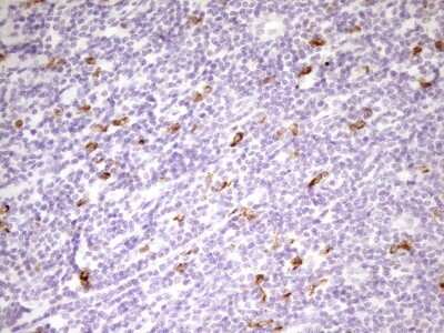 Immunohistochemistry: APOB48R Antibody (OTI1B1) [NBP2-46532]
