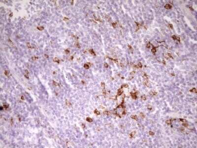 Immunohistochemistry: APOB48R Antibody (OTI1B1) [NBP2-46532]