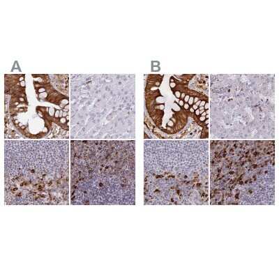 Immunohistochemistry-Paraffin: APOB48R Antibody [NBP1-90129]