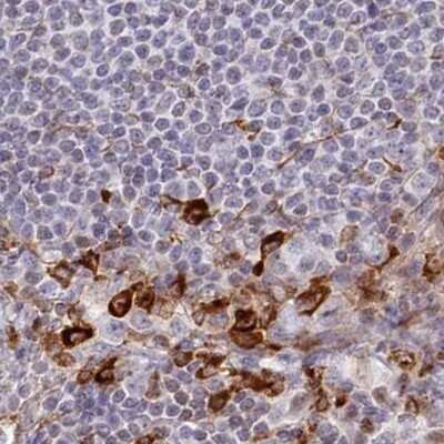 Immunohistochemistry-Paraffin: APOB48R Antibody [NBP1-90129]