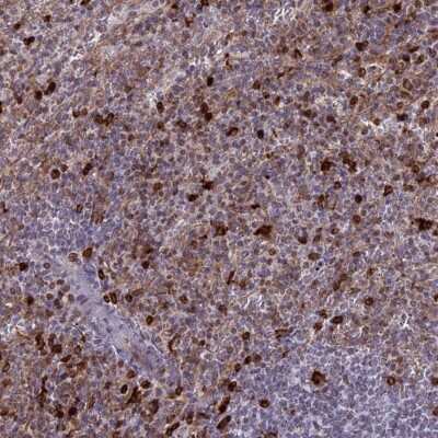 Immunohistochemistry-Paraffin: APOB48R Antibody [NBP1-90129]