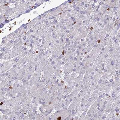 Immunohistochemistry-Paraffin: APOB48R Antibody [NBP1-90130]