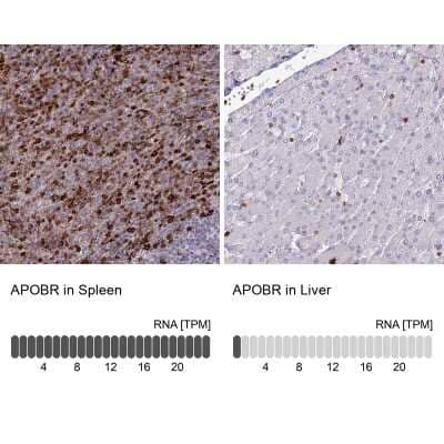 Immunohistochemistry-Paraffin: APOB48R Antibody [NBP1-90130]