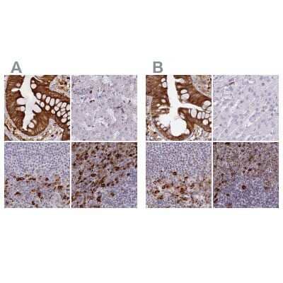 Immunohistochemistry-Paraffin: APOB48R Antibody [NBP1-90130]