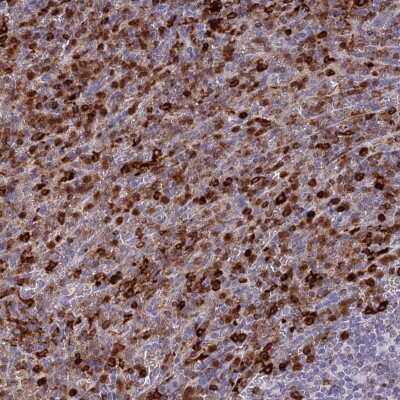Immunohistochemistry-Paraffin: APOB48R Antibody [NBP1-90130]