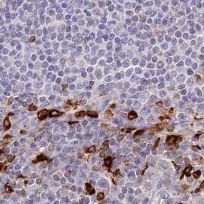 Immunohistochemistry-Paraffin: APOB48R Antibody [NBP1-90130]
