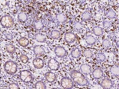 Immunohistochemistry-Paraffin: APOB48R Antibody [NBP2-98580]