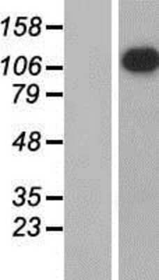 Western Blot: APOB48R Overexpression Lysate [NBP2-06779]