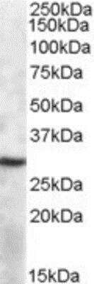 Western Blot: APOBEC1 Antibody [NBP1-06977]