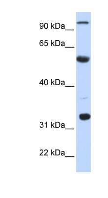 Western Blot: APOBEC1 Antibody [NBP1-57268]