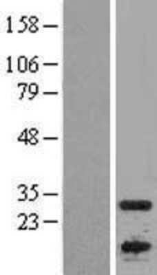 Western Blot: APOBEC1 Overexpression Lysate [NBL1-07612]