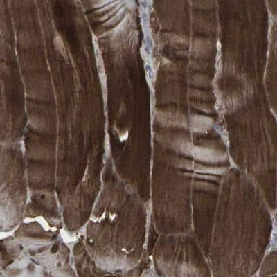 Immunohistochemistry: APOBEC2 Antibody [NBP1-88849]