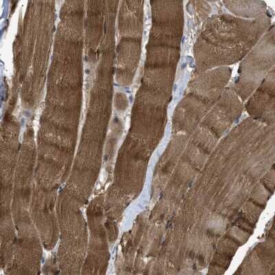 Immunohistochemistry-Paraffin: APOBEC2 Antibody [NBP1-88848]