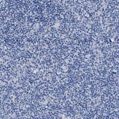 Immunohistochemistry-Paraffin: APOBEC2 Antibody [NBP1-88848]