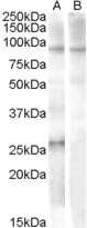 Western Blot: APOBEC2 Antibody [NB100-93372]