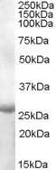 Western Blot: APOBEC2 Antibody [NB100-93451]