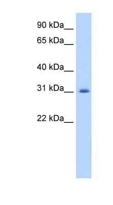 Western Blot: APOBEC2 Antibody [NBP1-57469]