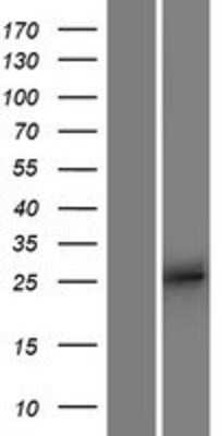 Western Blot: APOBEC2 Overexpression Lysate [NBP2-07578]