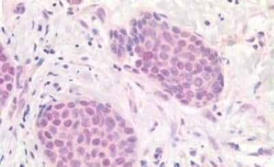 Immunohistochemistry-Paraffin: APOBEC3B Antibody [NBP3-14542]