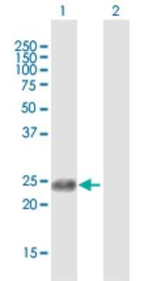 Western Blot: APOBEC3B Antibody [H00009582-B01P]