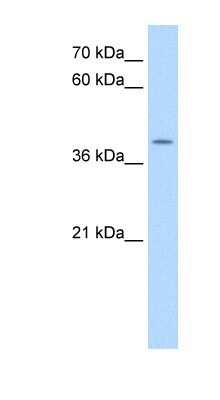 Western Blot: APOBEC3B Antibody [NBP1-57516]